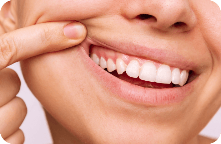  Our Specialised Periodontal Services